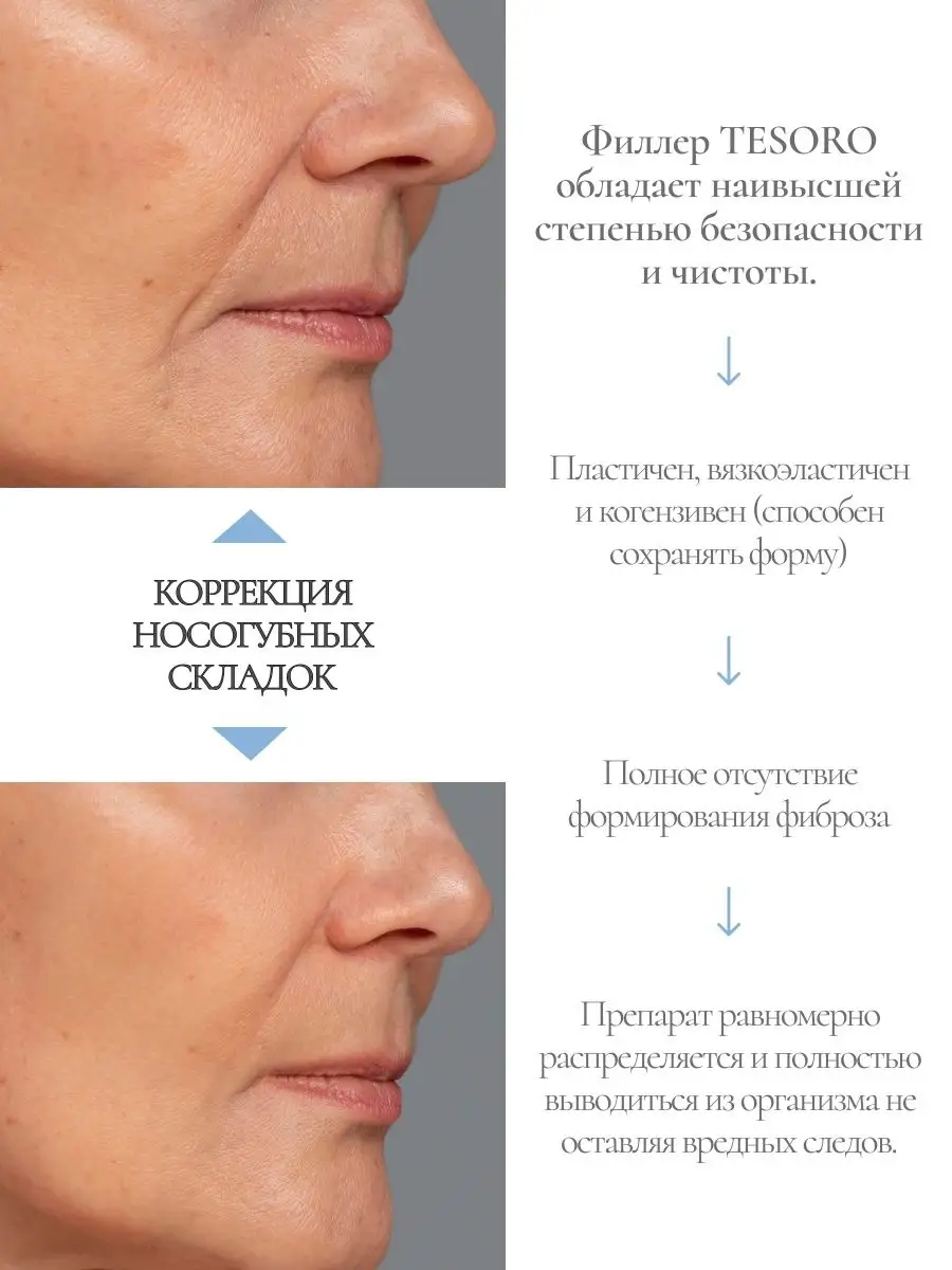 Монофазный дермальный филлер TESORO DEEP SEFINO купить по цене 0 сум в  интернет-магазине Wildberries в Узбекистане | 165642543