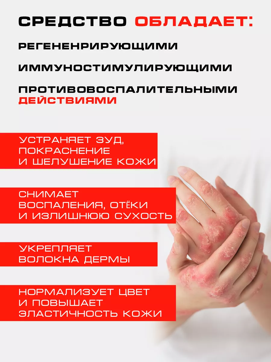 Мазь от псориаза дерматита Псориформ PsoriFORM купить по цене 546 ₽ в  интернет-магазине Wildberries | 179142914